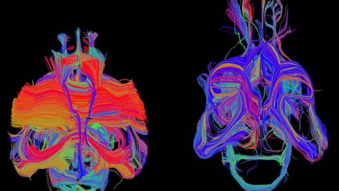 Research unit - Functional Neuroimaging